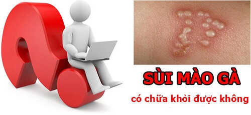 Bệnh sùi mào gà có chữa khỏi được không?